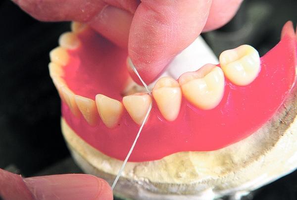 Fumar aumenta o risco de doenças periodontais, como gengivite e  periodontite, devido à redução da circulação sanguínea nas gengivas. Além…